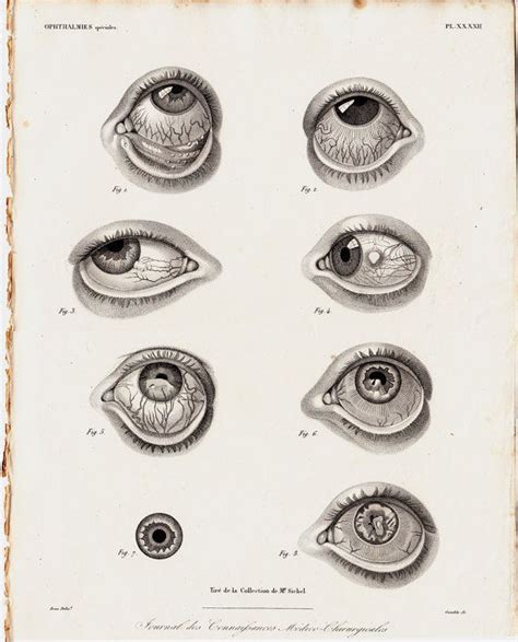 1835 Antique Eye Anatomy Print Fine Anatomy Lithograph The Eyes