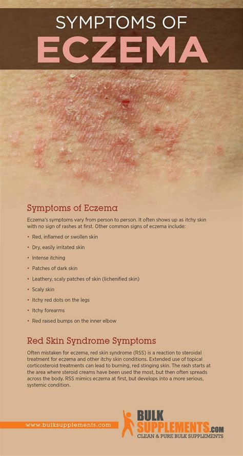 Get 37 Mild Eczema Bumps On Face