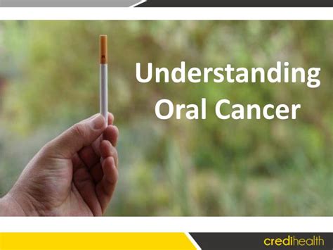 Ppt Understanding Oral Cancer Powerpoint Presentation Free Download