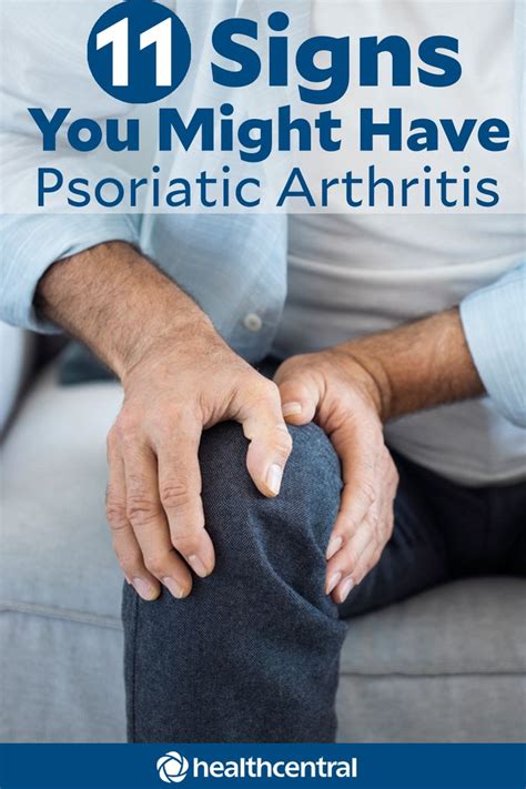 Do You Have Psoriatic Arthritis Watch For These 11 Signs Psoriatic