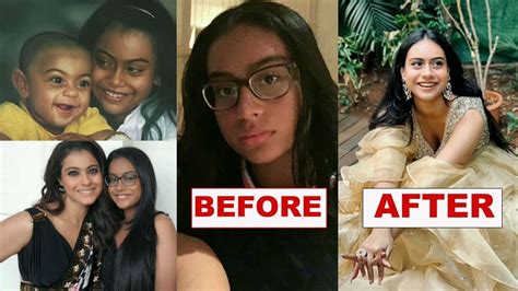 Kajol Daughter Nysa Devgan Amazing Transformation After Surgery Ajay Devgan And Kajol Youtube