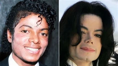 Michael Jackson Transformation How Much Plastic Surgery Did He