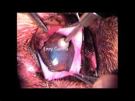 A patient's guide to refractive surgery. Diamond burr debridement of a corneal ulcer in a dog ...