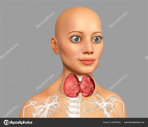 Hyperthyroidism Illustration Showing Enlarged Thyroid Gland