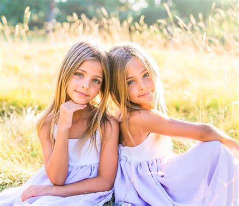 Sisters Dubbed The Most Beautiful Twins In The World Turn 9 Years Old