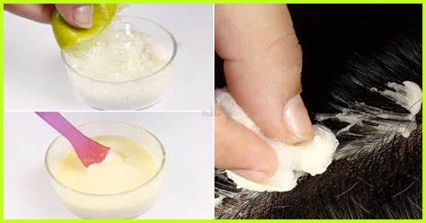 Step by step instructions to Use Baking Soda For Dandruff
