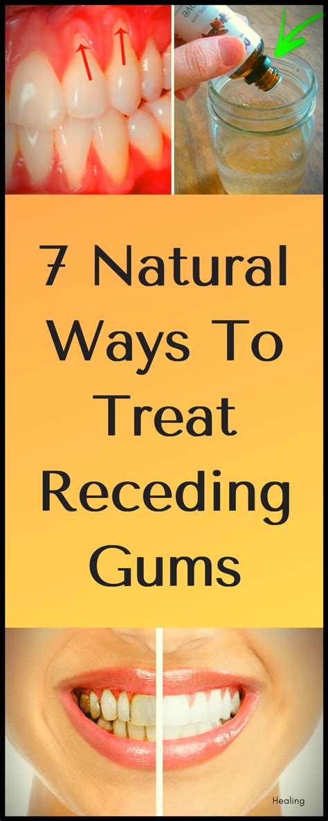 How To Cure Receding Gums Fast