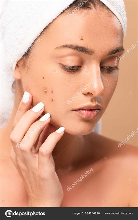 Naked Girl Towel Touching Face Acne Isolated Beige Stock Photo