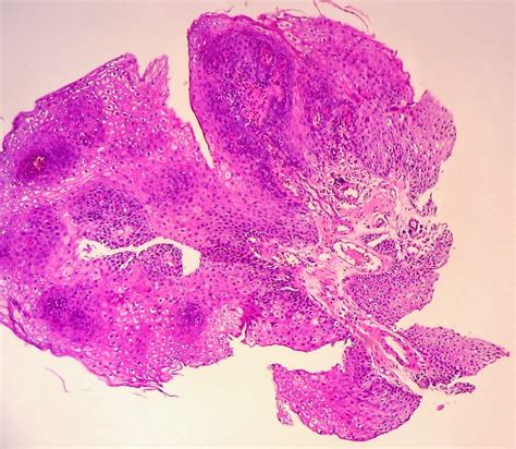 Gastrointestinal And Liver Histology Pathology Atlas Esophagus