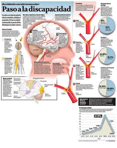 Accidente Cerebrovascular Paso A La Discapacidad Invdes