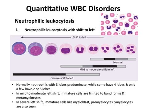 Benign White Blood Cell Wbc Disorders