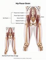 Hip Flexor Muscle Exercises Pictures