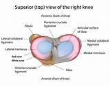 Pictures of Medial Meniscus Tear Therapy