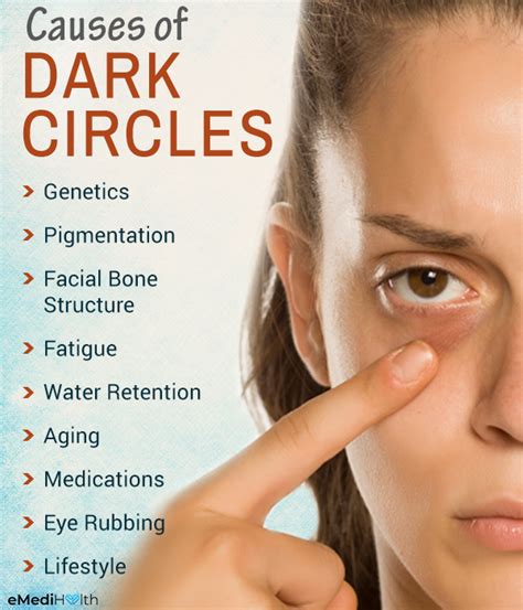 Dark Circles Under Eyes