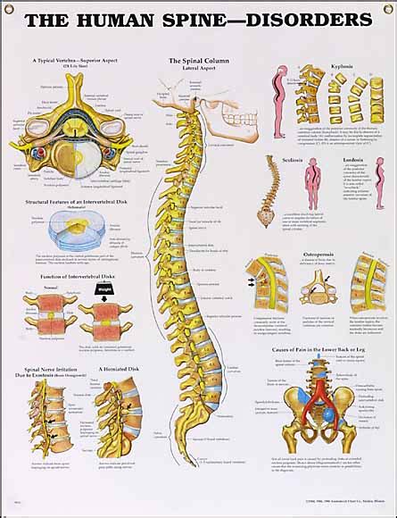 The Human Spine Disorders Anatomical Chart Physio Needs