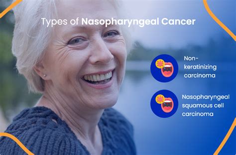 Nasopharyngeal Cancer Treatment Everything You Need To Know Actc