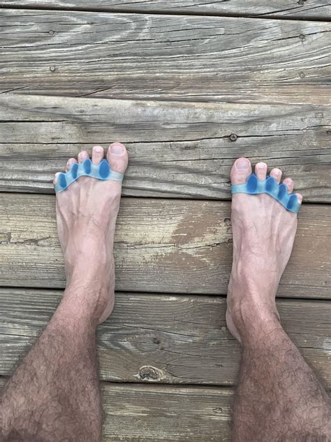 Working On My Toe Alignment Anyone Else Have Experience With These Or