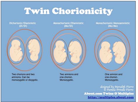 how to understand the terminology of having twins twin pregnancy how to have twins twin