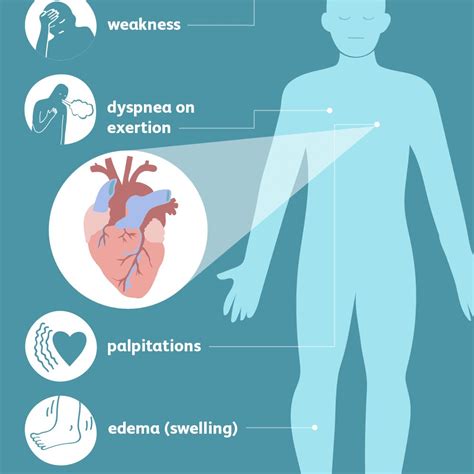 Congestive Heart Failure Causes And Symptoms