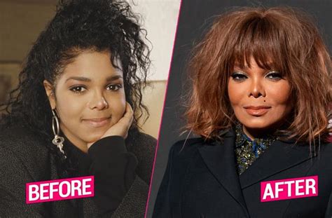 Janet Jackson Shocking Plastic Surgery Makeover Revealed