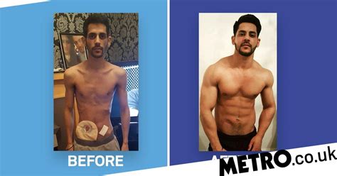 Mans Amazing Transformation After Crohns Disease Left Him Severely