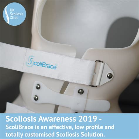 A Scoliosis Journey Week 3 Scoliosis Clinic Uk Treating Scoliosis