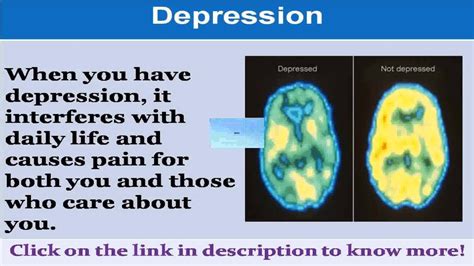 See Now How To Help My Husband With Depression Youtube