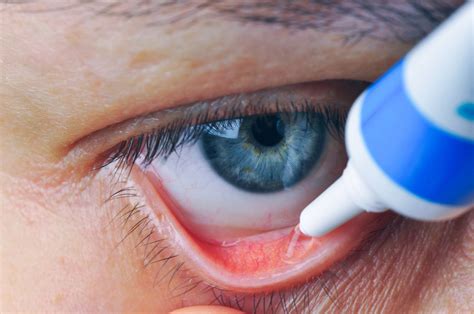 Antibiotic Eye Ointments Uses Side Effects Dosages