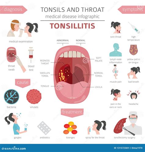 Tonsils And Throat Diseases Tonsillitis Symptoms Treatment Icon Set