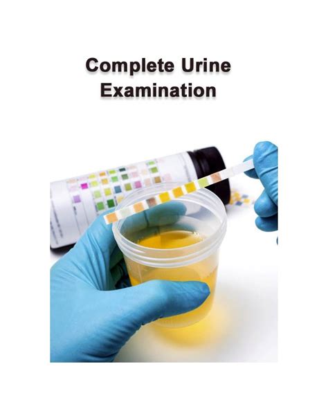 How To Read Complete Urine Examination Report