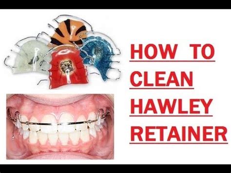 The thicker your hair and the less oil, the less you need to shampoo. {#176} HOW I CLEAN MY HAWLEY RETAINER - YouTube
