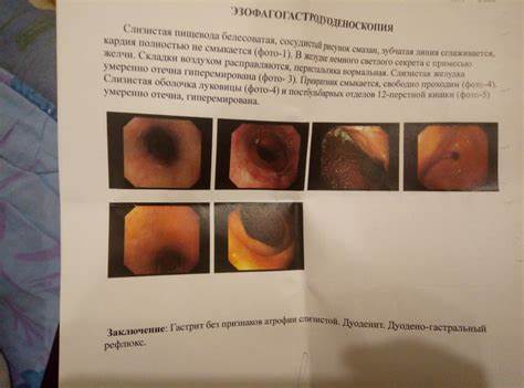 Гэрб, лечение не помогает - Вопрос гастроэнтерологу - 03 Онлайн Картинка - Гэрб, лечение не помогает - Вопрос гастроэнтерологу - 03 Онлайн