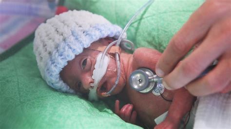 Premature Babies Bubs Thrive When Parents Take Over Care In Ward The