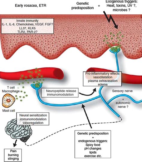 new insights into rosacea pathophysiology a review of recent findings journal of the american