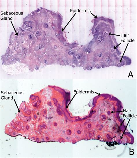 Most people outside the americas and australia should be labelled as native or none at all. Hair Follicle Microscope Labeled | Hairsjdi.org