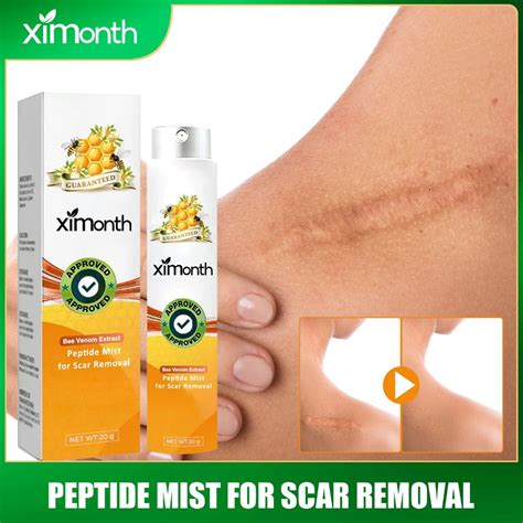 Ximonth Bee Venom Scar Removal Cream 20g Scar Remove Advanced Scar Spray For All Types Of Scars