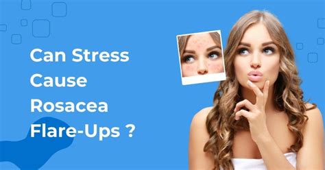 Can Stress Cause Rosacea Flare Ups Associated Dermatologist