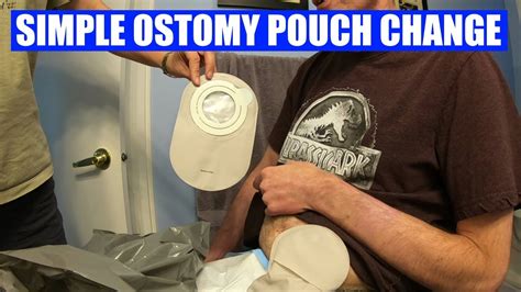 Changing A Colostomy Bag Quick And Easy Youtube