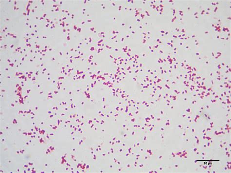 Метод выявления бактерий рода salmonella. Salmonella spp.