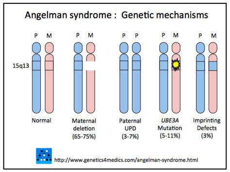Angelman Syndrome Vs Prad Acne Symptoms