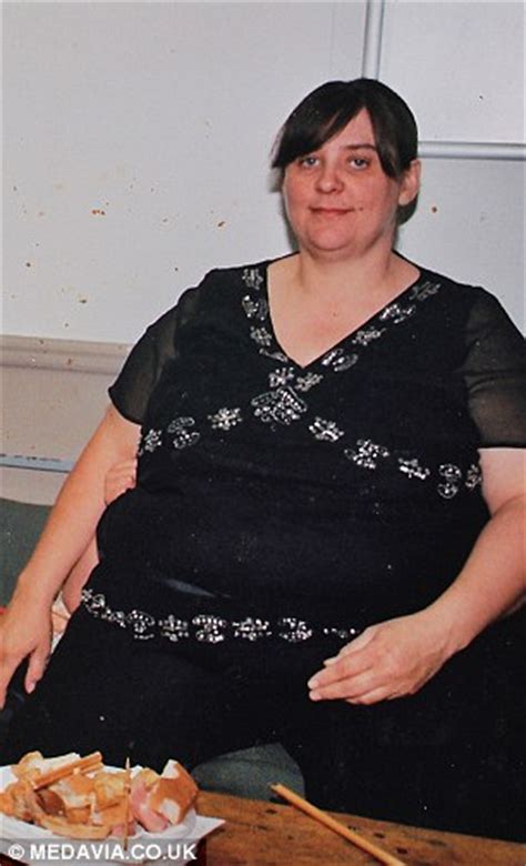 Mum Left With Huge Flap Of Saggy Skin After Losing 13st Begs The Nhs To