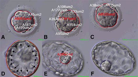 Prediction Of Human Blastocyst Development From Morulas With Delayed