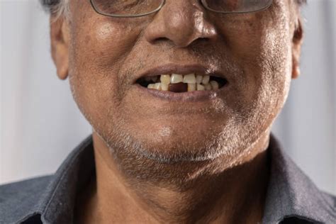 430 Toothless Old Man Stock Photos Pictures And Royalty Free Images