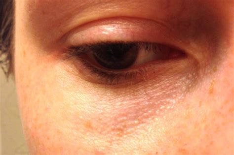Skin Concerns Advice For My Thin Under Eye Skin Visible Oil Glands