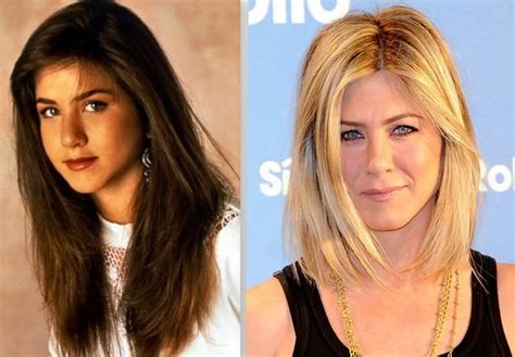 Jennifer Aniston Before And After A Nose Job Celebrity Plastic