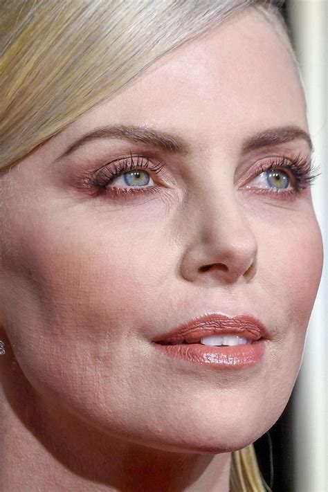 Miscellaneous What Caused These Patterns In Charlize Therons Cheek At The Golden Globes