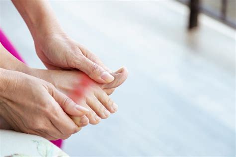 Steps To Take During A Gout Flare Up Great Lakes Foot And Ankle