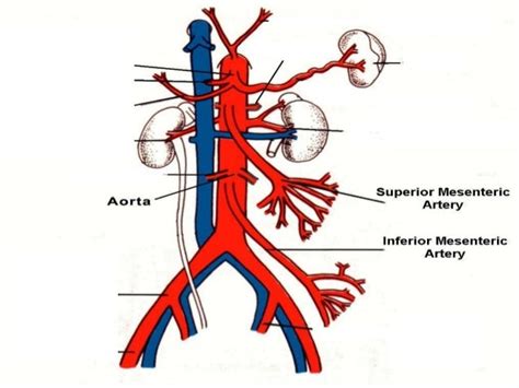 Superior Mesenteric Artery Model