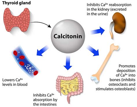 Pathology Outlines Calcitonin