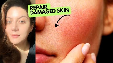 Repair Your Damaged Skin Barrier In 1 Week How To Treat Different Types Of Skin Damage